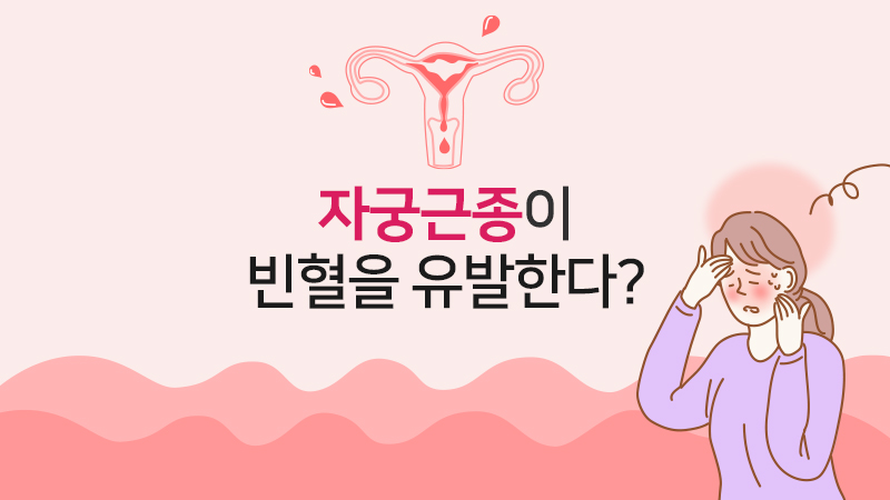 자궁근종이 빈혈을 유발한다?