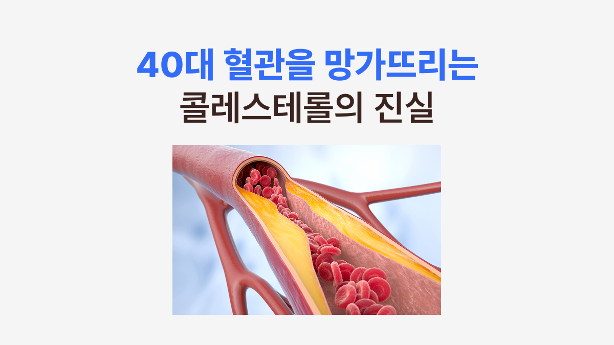 40대 혈관을 망가뜨리는 콜레스테롤의 진실